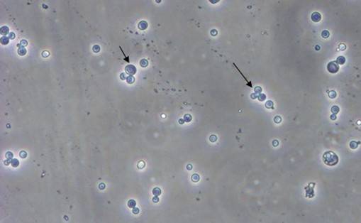 酵母双杂交技术原理、试验流程、特点以及应用
