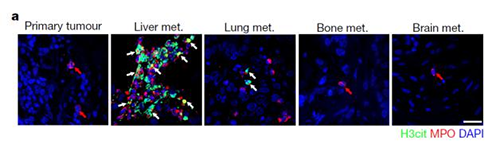 转入小鼠模型得到相同的试验结果，且在转移发生前NET已在肝脏聚积。