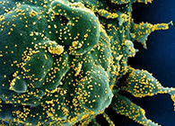 唾液检测新冠抗体新方法来了，获取结果仅需几小时！