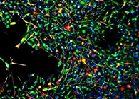 世界首创：药物将干细胞引导至受损部位，提高其愈合能力！