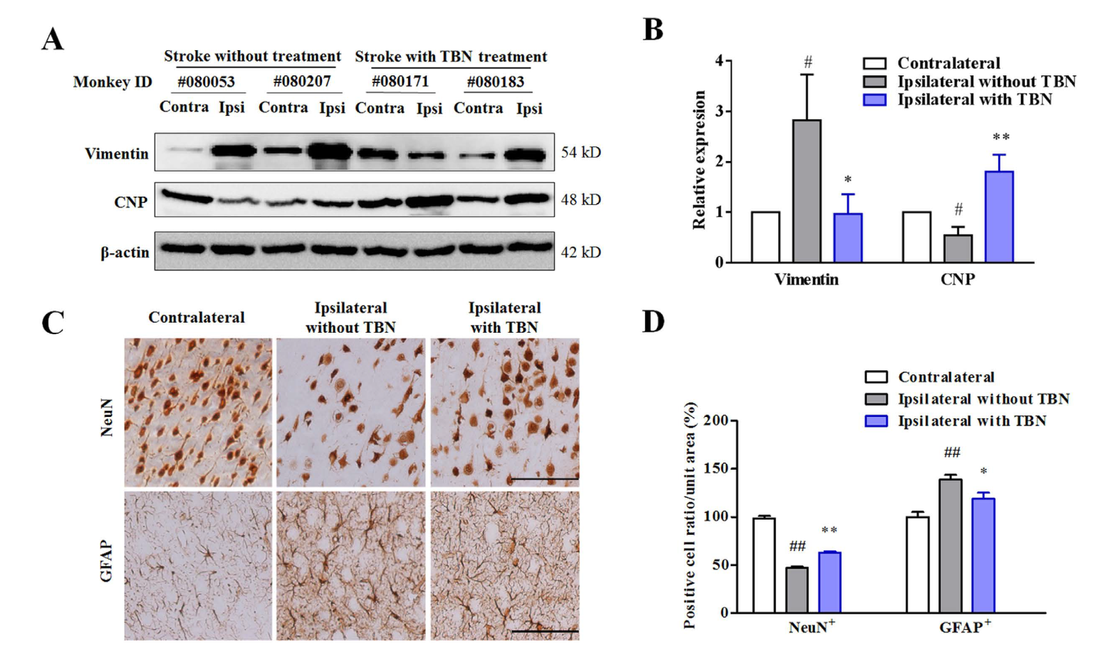 TBN是一种治疗缺血性卒中的新型临床候选药物，本研究中TBN通过HJC黄金城平台合成